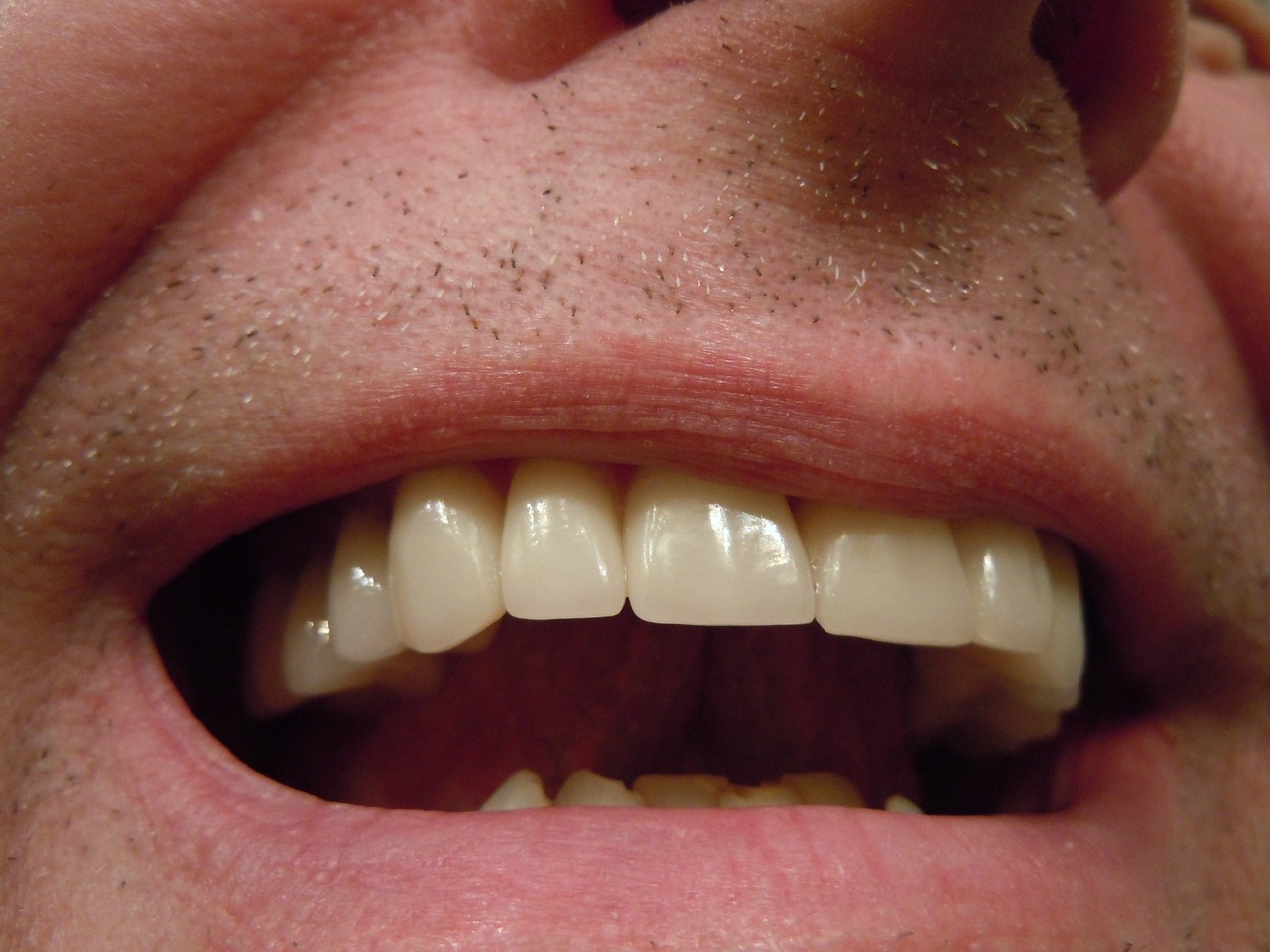 teeth-414489_1280